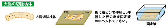 大腸の切除検体